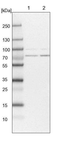 PIGB Antibody - BSA Free Western Blot: PIGB Antibody - BSA Free [NBP1-85856]