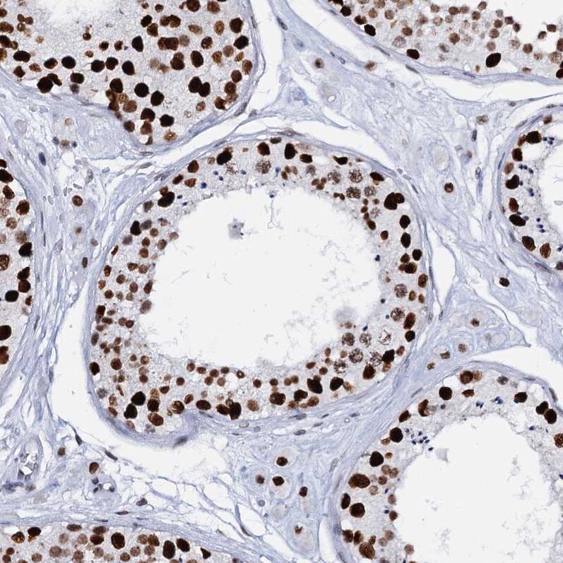 CMAS Antibody - BSA Free Immunohistochemistry-Paraffin: CMAS Antibody [NBP1-85858]