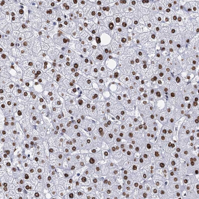 CMAS Antibody - BSA Free Immunohistochemistry-Paraffin: CMAS Antibody [NBP1-85858]