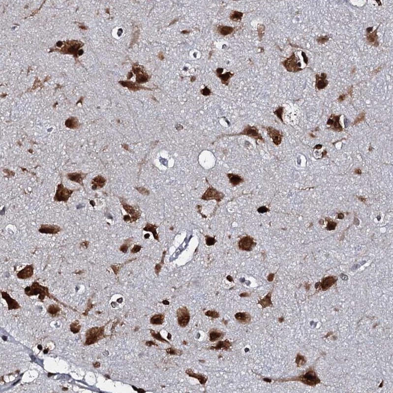 CMAS Antibody - BSA Free Immunohistochemistry-Paraffin: CMAS Antibody [NBP1-85858]
