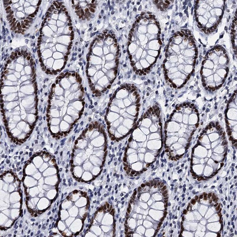 CMAS Antibody - BSA Free Immunohistochemistry-Paraffin: CMAS Antibody [NBP1-85858]