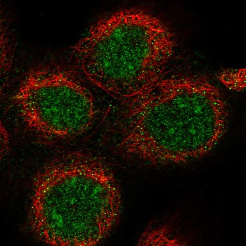 DDX51 Antibody - BSA Free Immunocytochemistry/ Immunofluorescence: DDX51 Antibody - BSA Free [NBP1-85859]