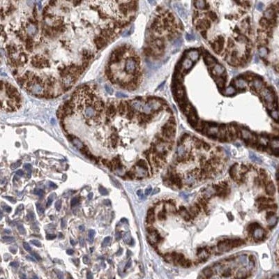 SUCLA2 Antibody - BSA Free Immunohistochemistry-Paraffin: SUCLA2 Antibody [NBP1-85860]