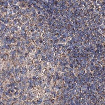 SUCLA2 Antibody - BSA Free Immunohistochemistry-Paraffin: SUCLA2 Antibody [NBP1-85860]