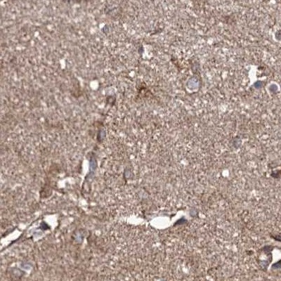 SUCLA2 Antibody - BSA Free Immunohistochemistry-Paraffin: SUCLA2 Antibody [NBP1-85860]