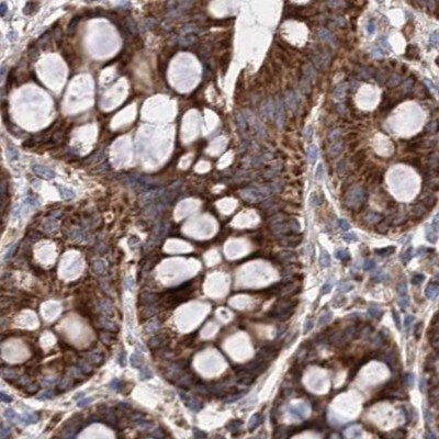 SUCLA2 Antibody - BSA Free Immunohistochemistry-Paraffin: SUCLA2 Antibody [NBP1-85860]