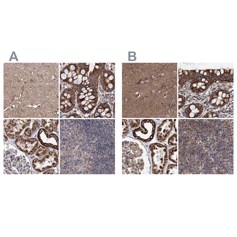 SUCLA2 Antibody - BSA Free Immunohistochemistry-Paraffin: SUCLA2 Antibody [NBP1-85860]