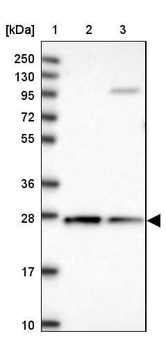 CYB5R2 Antibody - BSA Free Western Blot: CYB5R2 Antibody - BSA Free [NBP1-85865]