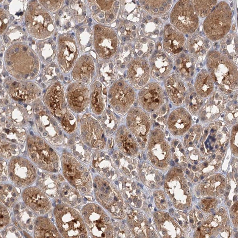 SNX15 Antibody - BSA Free Immunohistochemistry-Paraffin: SNX15 Antibody [NBP1-85866]