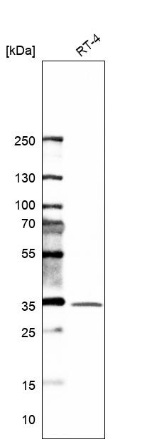 Syntaxin 6 Antibody - BSA Free Western Blot: Syntaxin 6 Antibody - BSA Free [NBP1-85869]