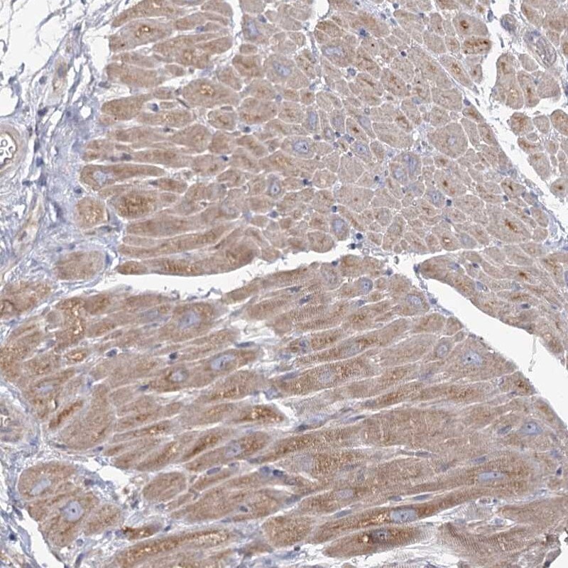 Angiopoietin-like Protein 5/ANGPTL5 Antibody - BSA Free Immunohistochemistry-Paraffin: Angiopoietin-like Protein 5/ANGPTL5 Antibody [NBP1-85870]