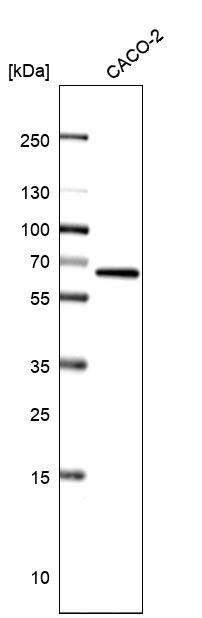ATE1 Antibody - BSA Free Western Blot: ATE1 Antibody - BSA Free [NBP1-85872]
