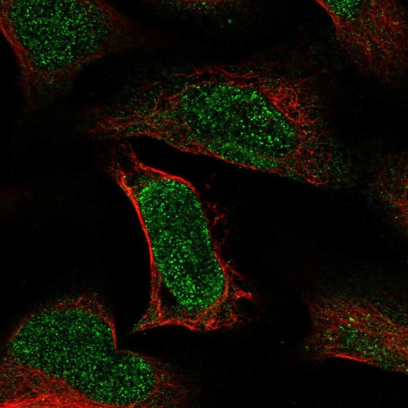 ATE1 Antibody - BSA Free Immunocytochemistry/ Immunofluorescence: ATE1 Antibody - BSA Free [NBP1-85872]