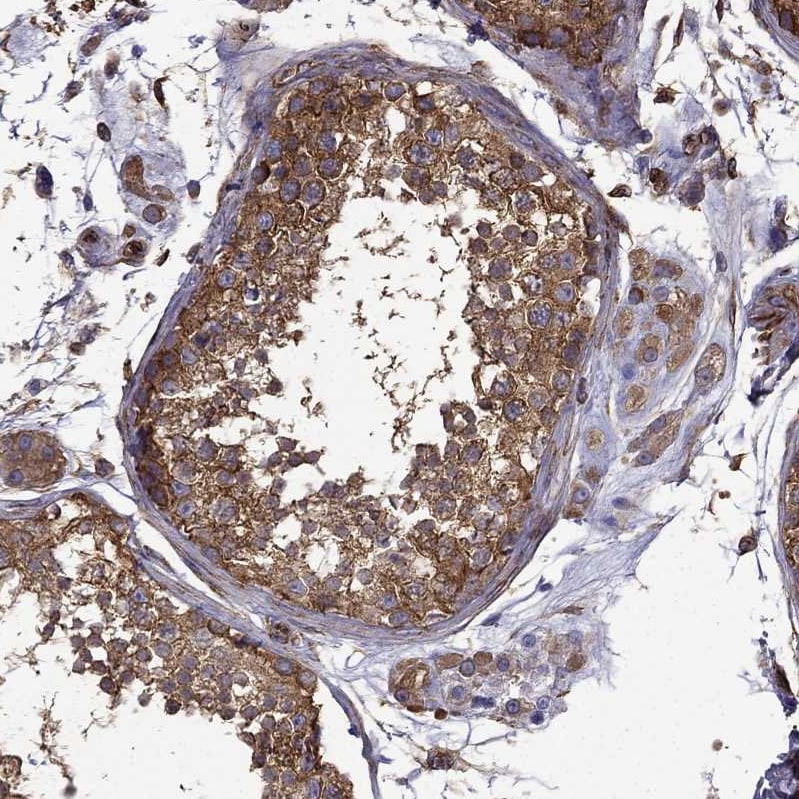 MAP4 Antibody - BSA Free Immunohistochemistry-Paraffin: MAP4 Antibody - BSA Free [NBP1-85874]