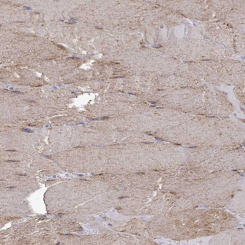 MAP4 Antibody - BSA Free Immunohistochemistry-Paraffin: MAP4 Antibody - BSA Free [NBP1-85874]