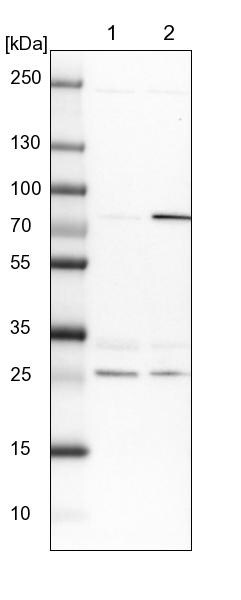 GBE1 Antibody - BSA Free Western Blot: GBE1 Antibody - BSA Free [NBP1-85875]