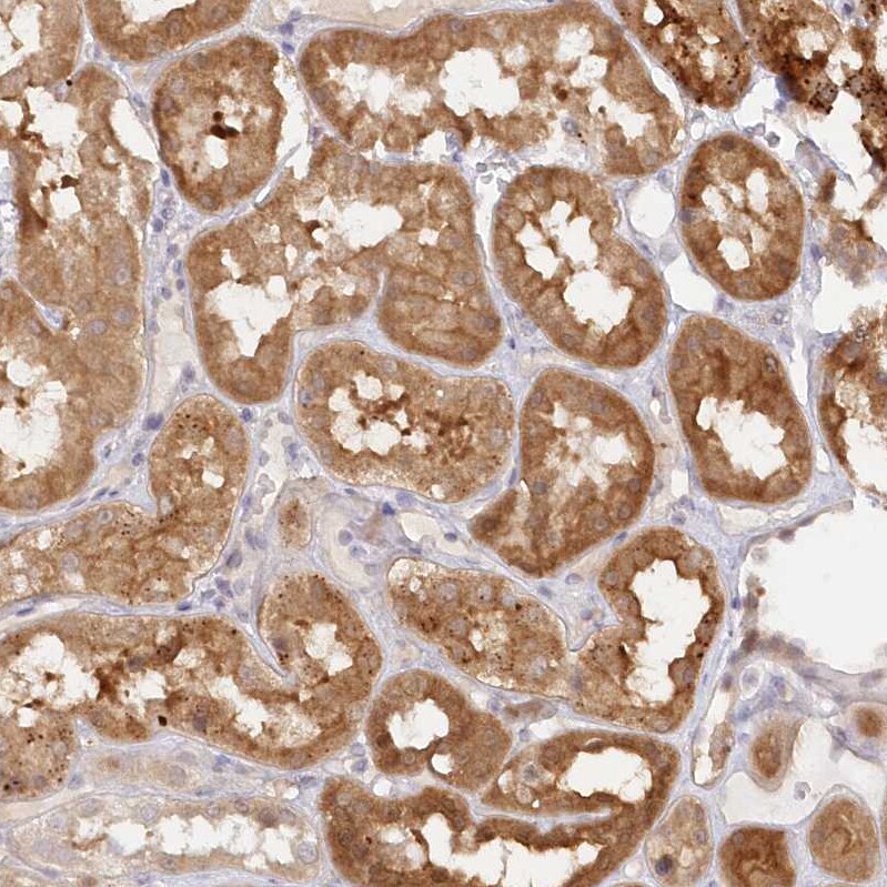 GBE1 Antibody - BSA Free Immunohistochemistry-Paraffin: GBE1 Antibody - BSA Free [NBP1-85877]