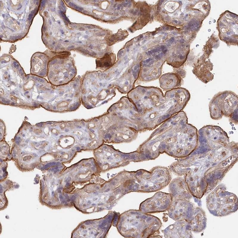 GBE1 Antibody - BSA Free Immunohistochemistry-Paraffin: GBE1 Antibody - BSA Free [NBP1-85877]