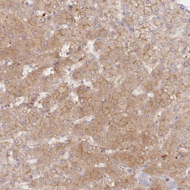 GBE1 Antibody - BSA Free Immunohistochemistry-Paraffin: GBE1 Antibody - BSA Free [NBP1-85877]