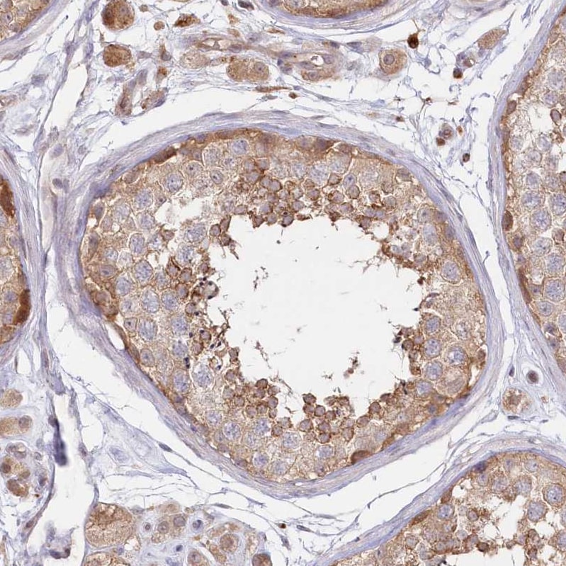 GBE1 Antibody - BSA Free Immunohistochemistry-Paraffin: GBE1 Antibody - BSA Free [NBP1-85877]