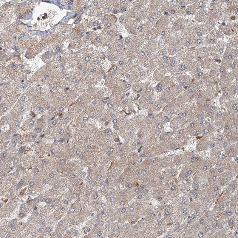 C12orf4 Antibody - BSA Free Immunohistochemistry-Paraffin: C12orf4 Antibody - BSA Free [NBP1-85878]