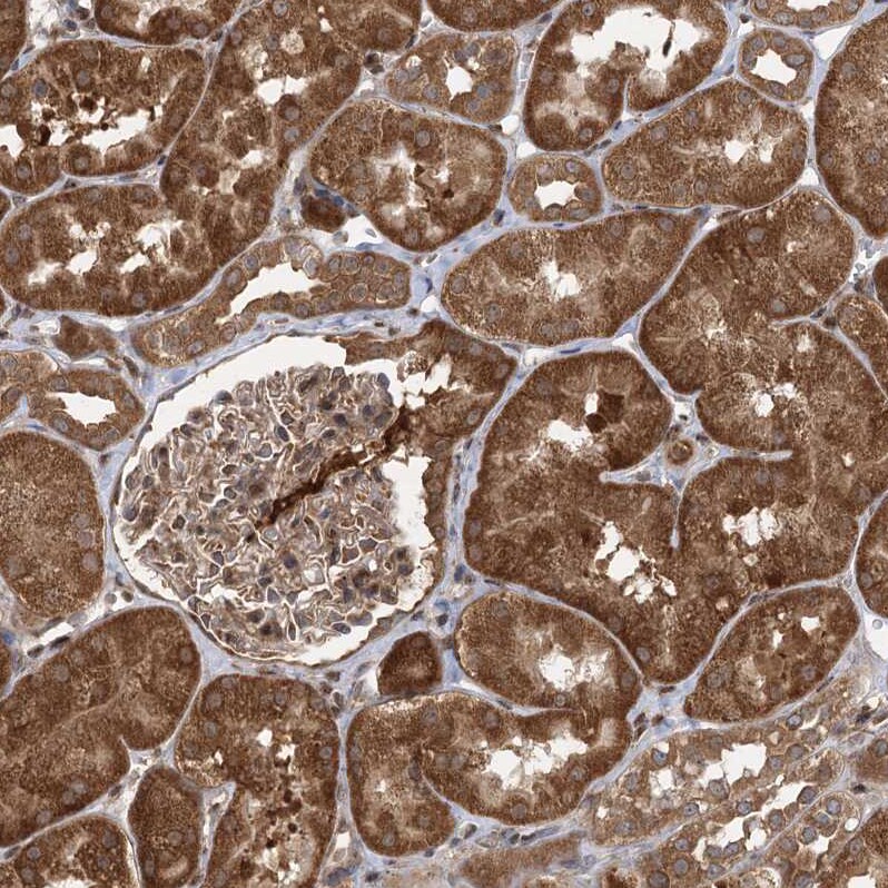 C12orf4 Antibody - BSA Free Immunohistochemistry-Paraffin: C12orf4 Antibody - BSA Free [NBP1-85878]
