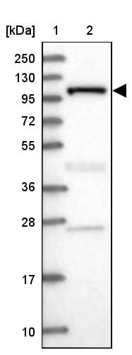 INPP4B Antibody - BSA Free Western Blot: INPP4B Antibody - BSA Free [NBP1-85883]