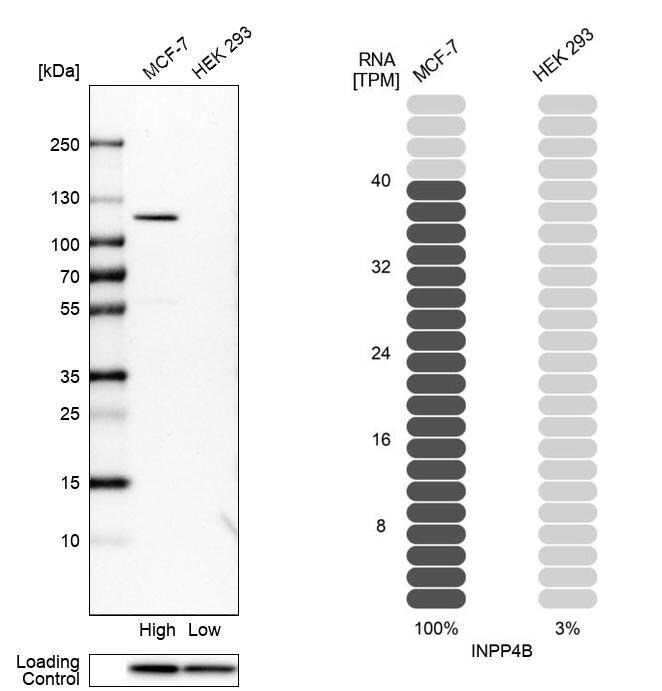 INPP4B Antibody - BSA Free Western Blot: INPP4B Antibody - BSA Free [NBP1-85883]