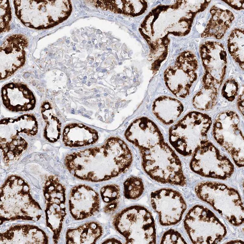 PCCB Antibody - BSA Free Immunohistochemistry-Paraffin: PCCB Antibody - BSA Free [NBP1-85886]