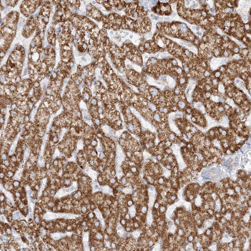 PCCB Antibody - BSA Free Immunohistochemistry-Paraffin: PCCB Antibody - BSA Free [NBP1-85886]
