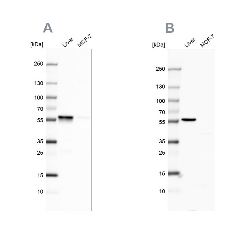 PCCB Antibody - BSA Free Western Blot: PCCB Antibody - BSA Free [NBP1-85886]