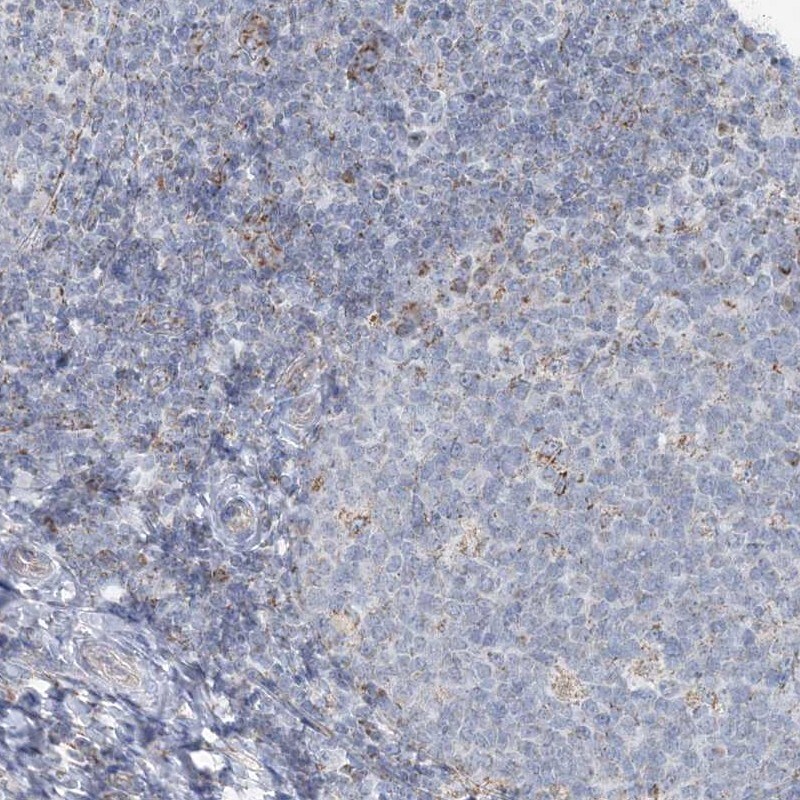 PCCB Antibody - BSA Free Immunohistochemistry-Paraffin: PCCB Antibody - BSA Free [NBP1-85887]