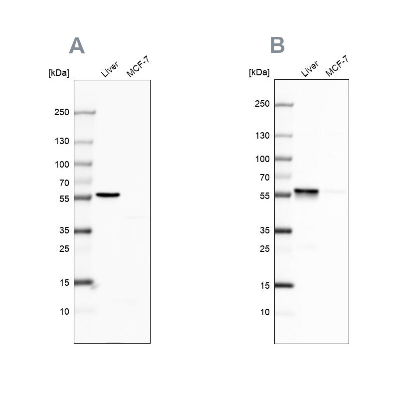 PCCB Antibody - BSA Free Western Blot: PCCB Antibody - BSA Free [NBP1-85887]