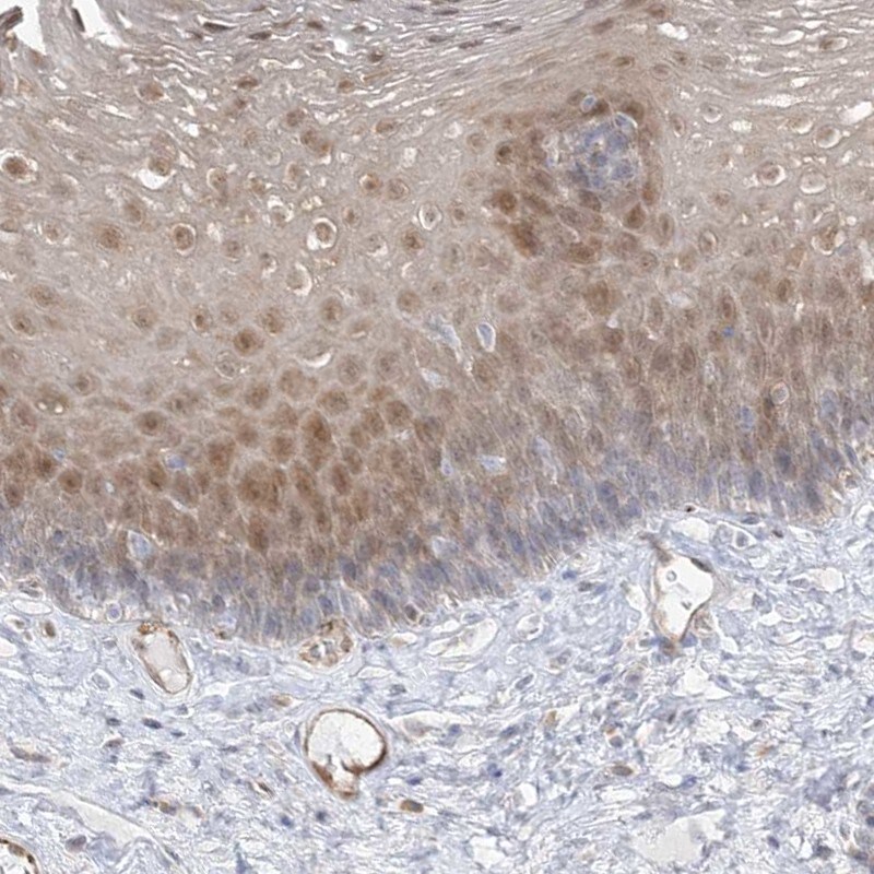 INPP1 Antibody - BSA Free Immunohistochemistry: INPP1 Antibody - BSA Free [NBP1-85889]