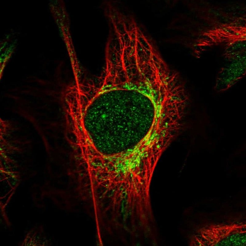 HIBCH Antibody - BSA Free Immunocytochemistry/ Immunofluorescence: HIBCH Antibody [NBP1-85891]