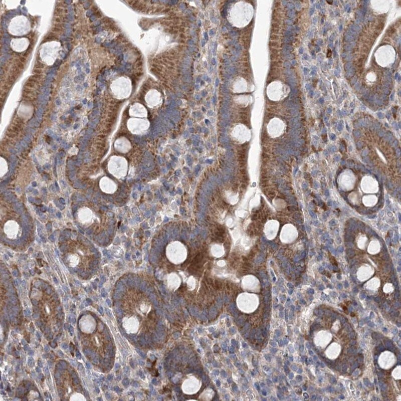 MTRF1L Antibody - BSA Free Immunohistochemistry-Paraffin: MTRF1L Antibody [NBP1-85893]