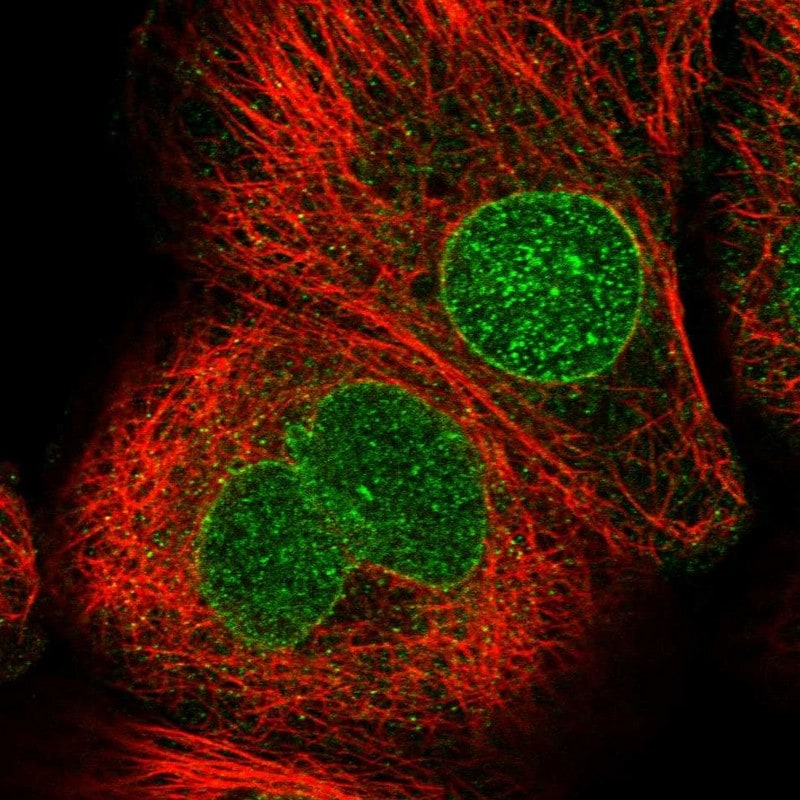 CDS1 Antibody - BSA Free Immunocytochemistry/ Immunofluorescence: CDS1 Antibody [NBP1-85894]