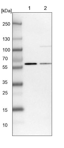 UMPS Antibody - BSA Free Western Blot: UMPS Antibody - BSA Free [NBP1-85895]