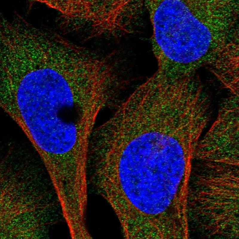 UMPS Antibody - BSA Free Immunocytochemistry/ Immunofluorescence: UMPS Antibody - BSA Free [NBP1-85896]