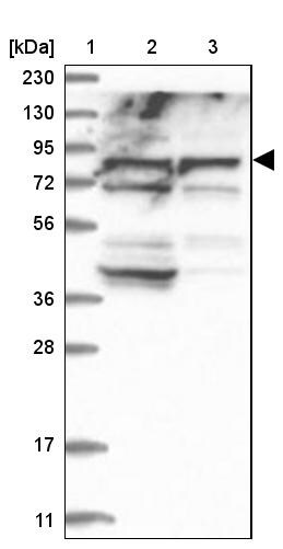 ACOX3 Antibody - BSA Free Western Blot: ACOX3 Antibody - BSA Free [NBP1-85900]