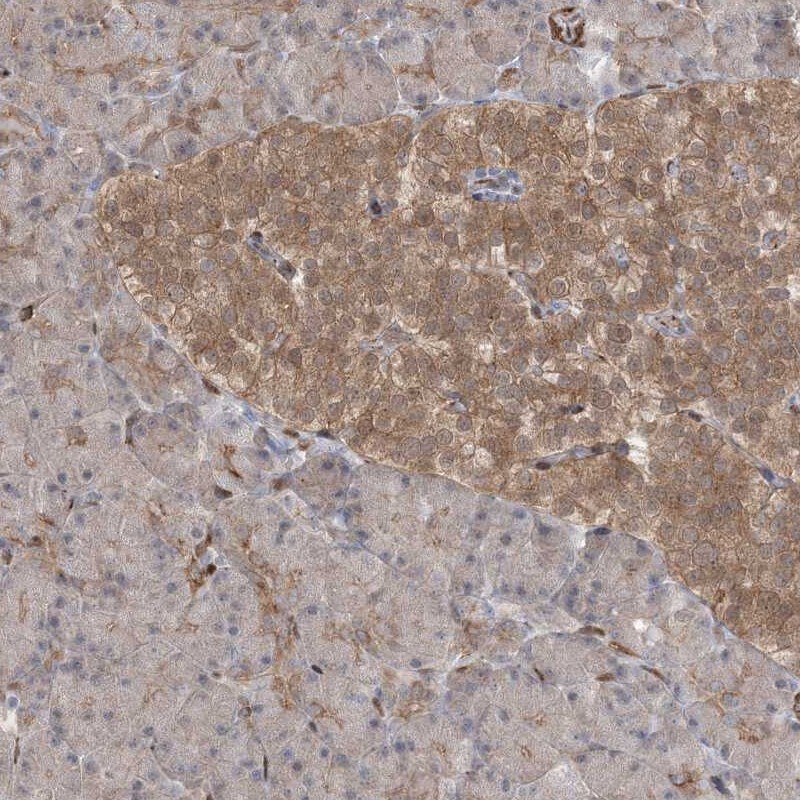 RIN1 Antibody - BSA Free Immunohistochemistry-Paraffin: RIN1 Antibody [NBP1-85905]