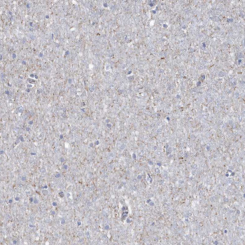 Rab17 Antibody - BSA Free Immunohistochemistry-Paraffin: Rab17 Antibody - BSA Free [NBP1-85910]