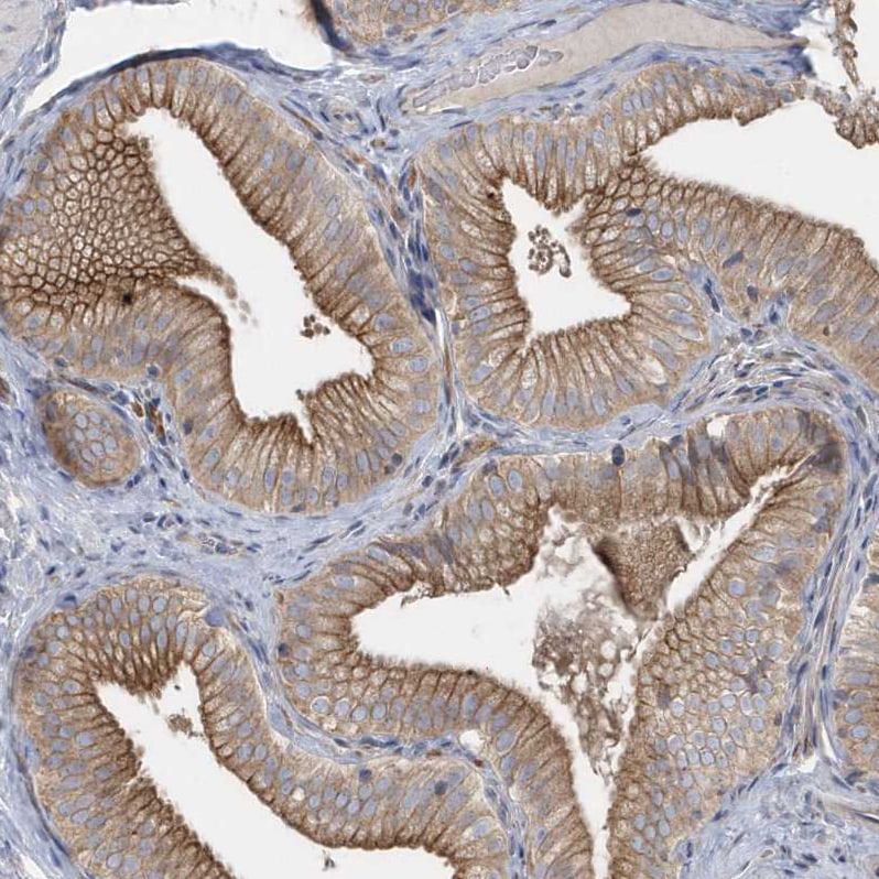 Rab17 Antibody - BSA Free Immunohistochemistry-Paraffin: Rab17 Antibody - BSA Free [NBP1-85910]