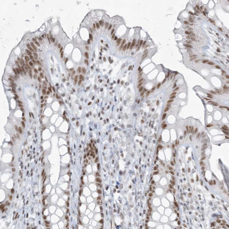 ZNF787 Antibody - BSA Free Immunohistochemistry-Paraffin: ZNF787 Antibody - BSA Free [NBP1-85911]