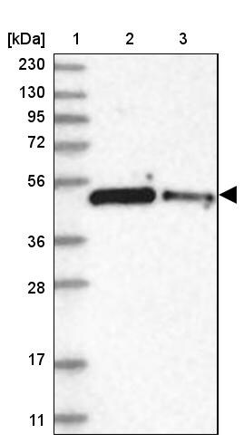 ZNF787 Antibody - BSA Free Western Blot: ZNF787 Antibody - BSA Free [NBP1-85911]