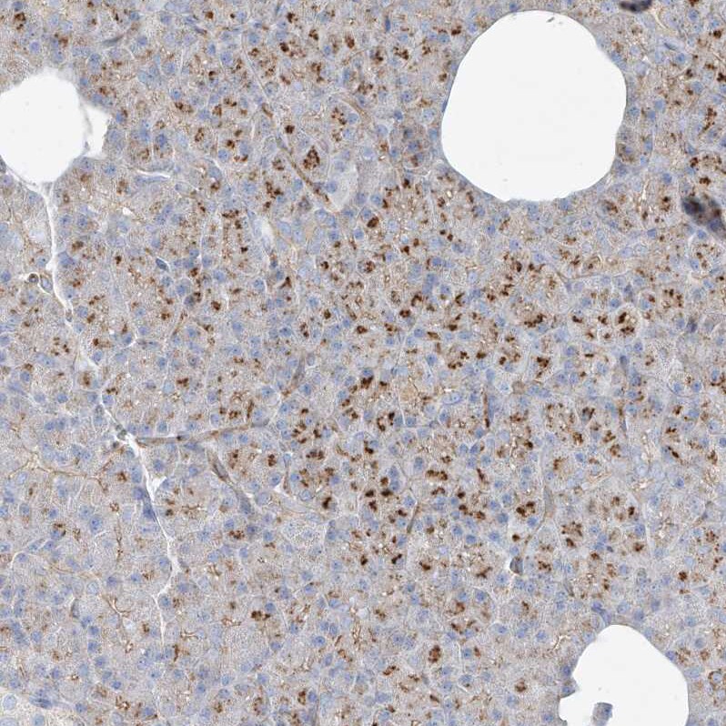 VAMP-5 Antibody - BSA Free Immunohistochemistry-Paraffin: VAMP-5 Antibody - BSA Free [NBP1-85913]