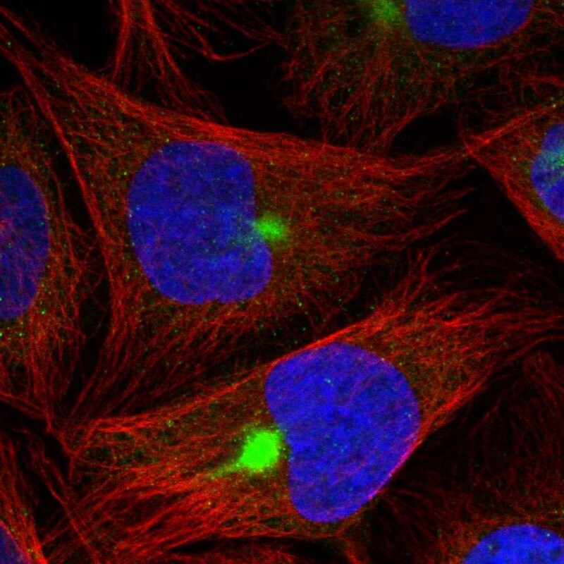 ZNF189 Antibody - BSA Free Immunocytochemistry/ Immunofluorescence: ZNF189 Antibody - BSA Free [NBP1-85915]