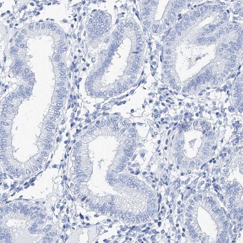 TSPYL6 Antibody - BSA Free Immunohistochemistry-Paraffin: TSPYL6 Antibody [NBP1-85917]