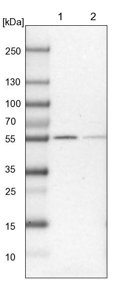 UGP2 Antibody - BSA Free Western Blot: UGP2 Antibody - BSA Free [NBP1-85918]