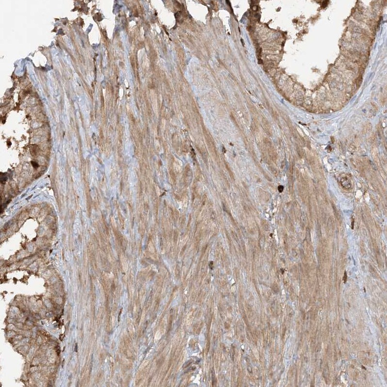 CAPZB Antibody - BSA Free Immunohistochemistry-Paraffin: CAPZB Antibody - BSA Free [NBP1-85922]